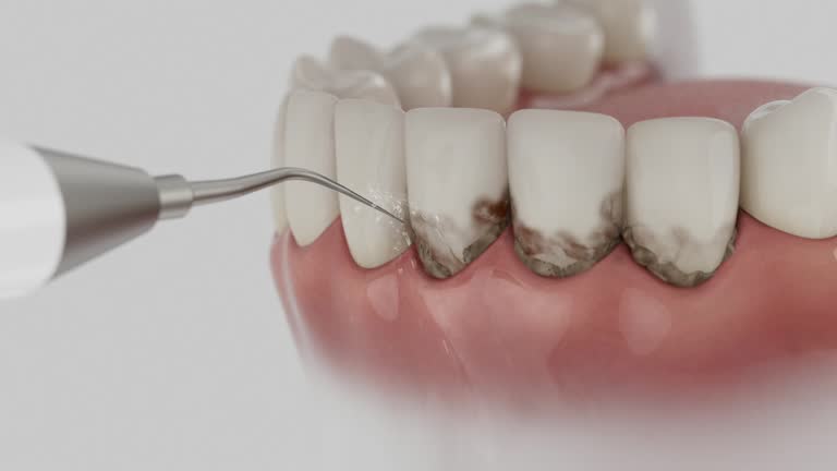Trusted Dental Crowns And Bridges service in Haworth, NJ - Dentist Open Now